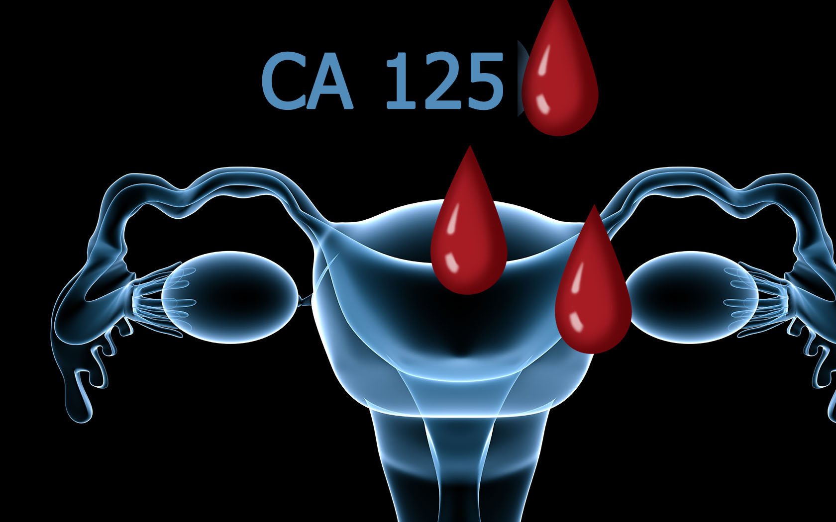 Ca 125. Опухолевый маркер CA-125. Раковый антиген са 125. Маркер на яичники са 125. Онкомаркеры CA 125.