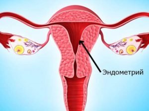 Какое значение имеет эндометрий матки в гинекологии